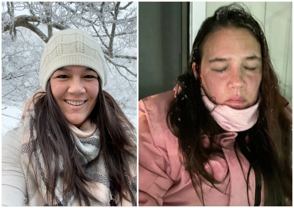 before and after skiing